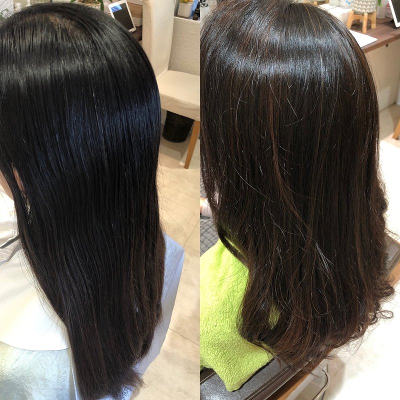 円形脱毛症のケア 株 H Feel 酒井智章のnote Note