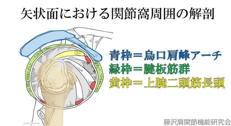 意外と多い 上腕二頭筋長頭腱炎の病態 藤沢肩関節機能研究会 郷間 Note