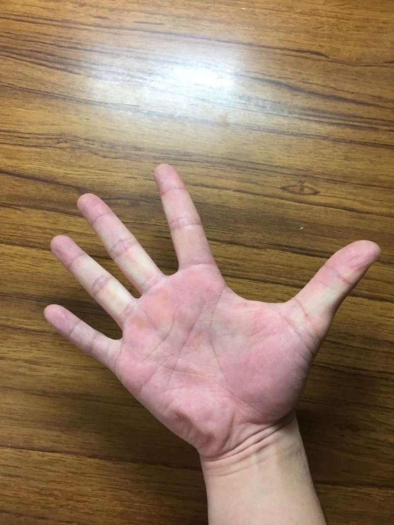 手を大きく開こう 児島 和也 Note 手を大きく開こう 児島 和也 Note