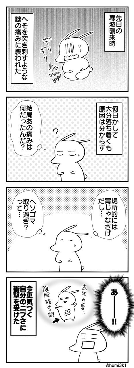 天候によって傷口が痛む事があるって聞いた事はあったけどコレか…！
#エッセイ #マンガ #日常 #4コマ漫画