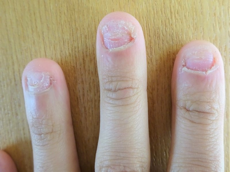 メッターと爪噛み メッター Note