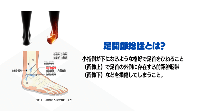 キック動作と軸足足首の痛み サッカー選手 向けフィジカルサポートnote 石橋 哲平 Note キック動作と軸足足首の痛み サッカー選手 向けフィジカルサポートnote 石橋 哲平 Note