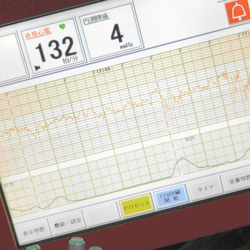 男性目線 無痛分娩のメリットをご紹介します かごやさん Note