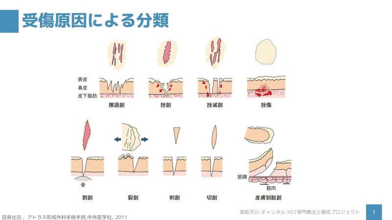 裂傷 と 剥離 の 違い