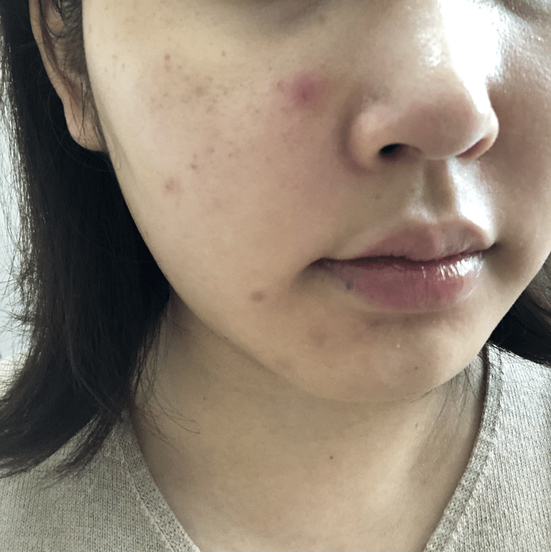 禁煙 肌断食初日 Ayanatural Note