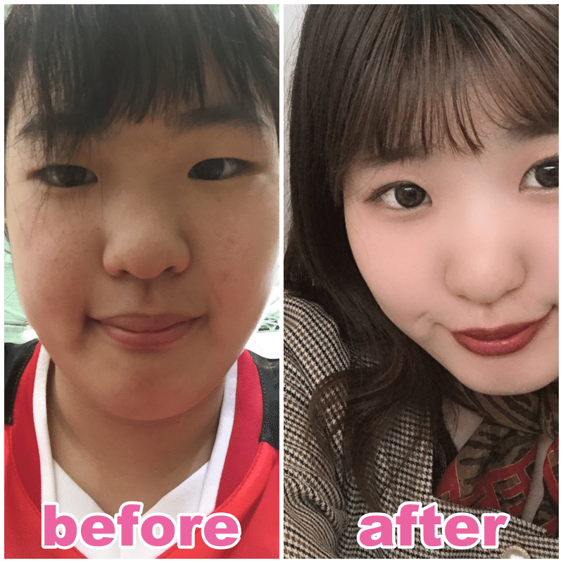 可愛くなりたいと思ったきっかけはyoutuber 美容医療 整形の口コミ予約アプリ トリビュー Note