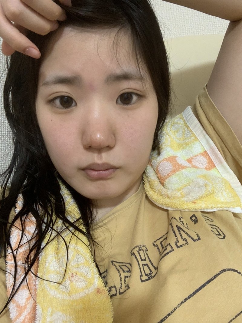 可愛くなりたいと思ったきっかけはyoutuber 美容医療 整形の口コミ予約アプリ トリビュー Note