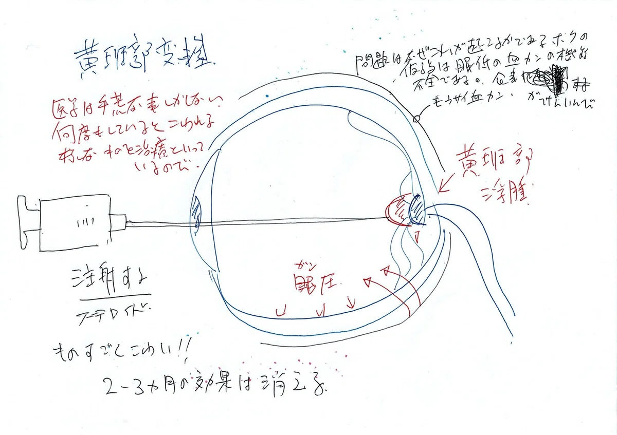 良い医者悪い医者眼底
