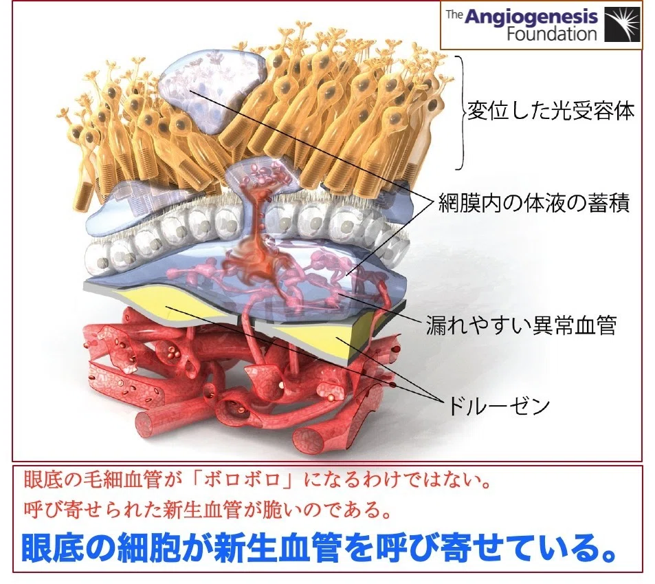 眼底