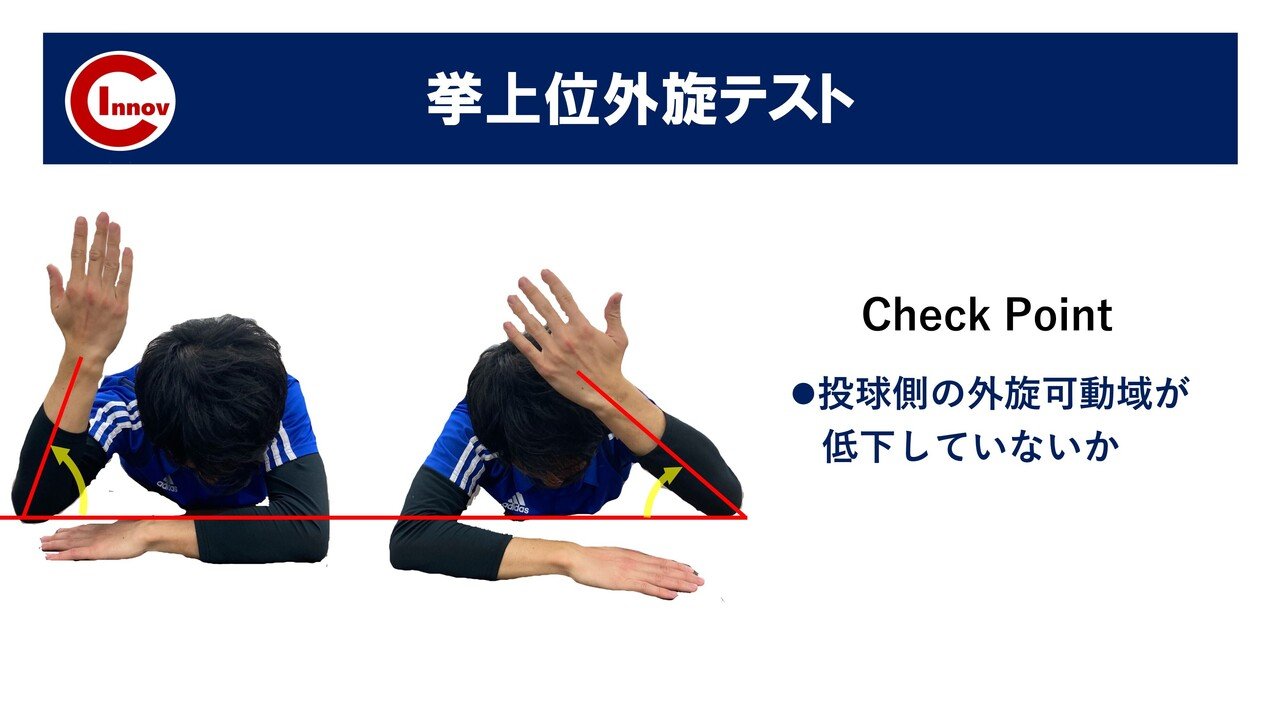 投球障害：肩・肘の障害予防 DVD 投球障害肩に対するアプローチ～急性期から復帰に向けて