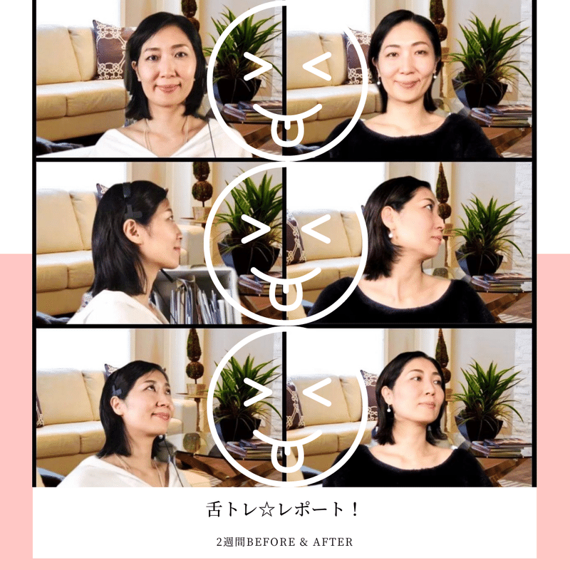 小顔効果まであるなんて 驚異の舌トレ2週間レポート Formachika Note 小顔効果まであるなんて 驚異の舌トレ2週間レポート Formachika Note