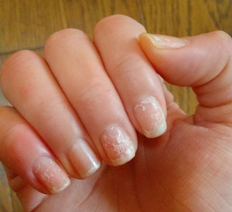 ネイルエンビーが本物か偽物なのか分からない件 さかま ゆう Note