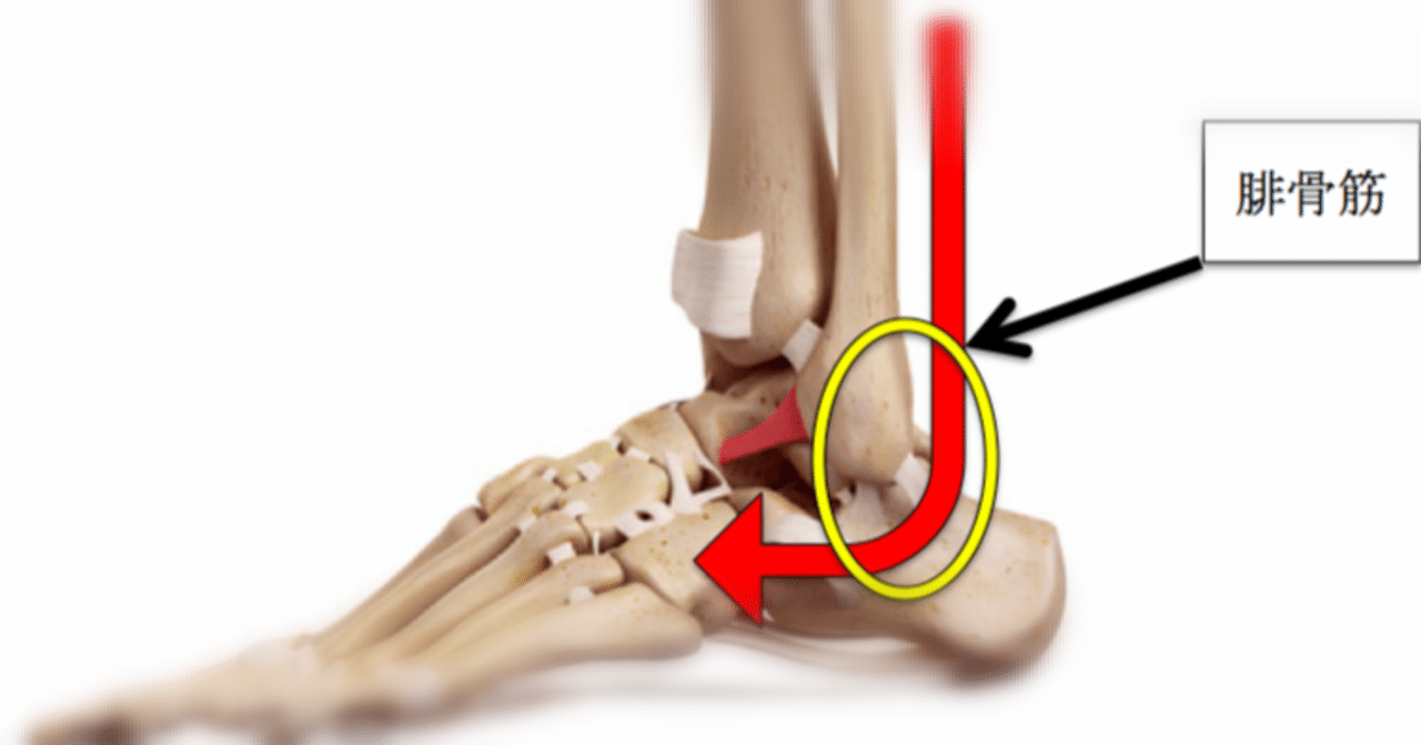 腓骨筋腱脱臼の術後リハビリテーション 貴さん理学療法士 エンタメ Note