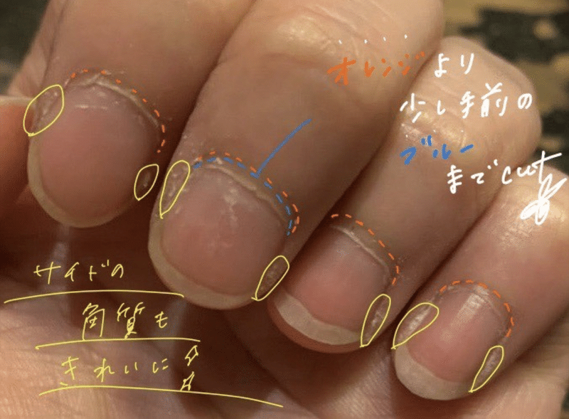 爪解説 甘皮ケアをおすすめする爪 Nail Mate Note 爪解説 甘皮ケアをおすすめする爪 Nail Mate Note