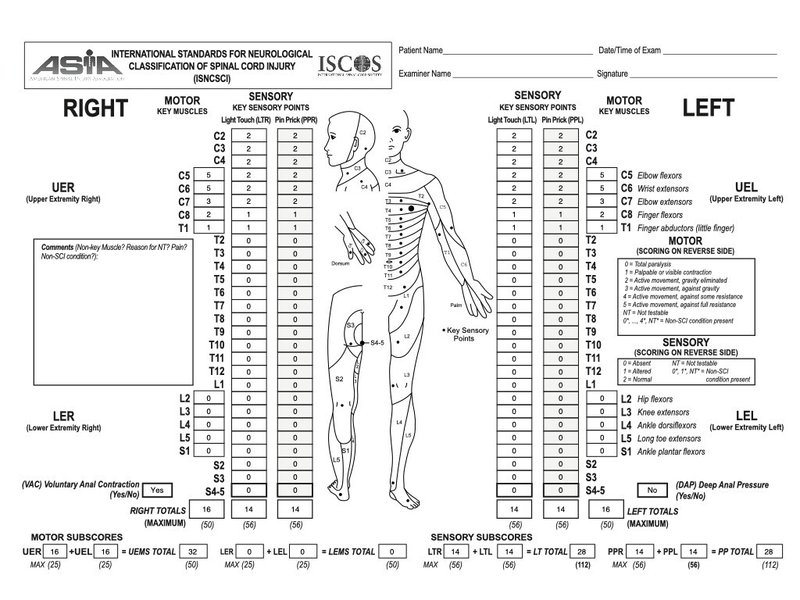 完全版 脊髄損傷の鉄板評価はこれだっ そうちゃん 脊髄損傷の情報発信 Note