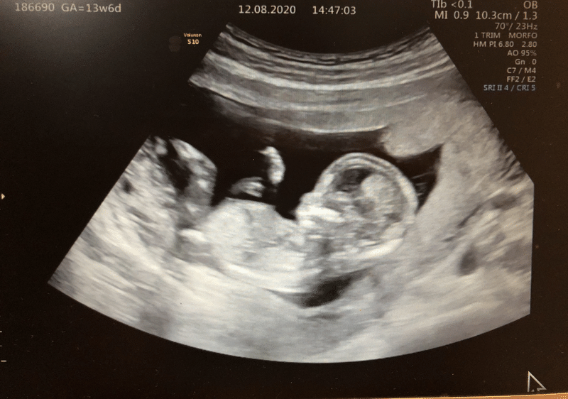 サンパウロで妊婦健診 初診 4ヶ月 みかりん 日本語教師x駐在妻 Note サンパウロで妊婦健診 初診 4ヶ月 みかりん 日本語教師x駐在妻 Note