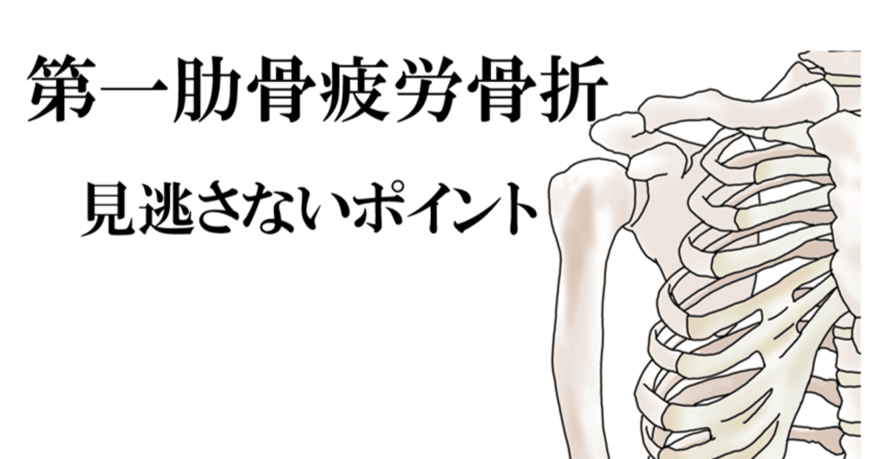 第一肋骨疲労骨折 見逃さないポイント Y K Note 第一肋骨疲労骨折 見逃さないポイント Y K Note