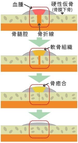 関節の バキバキ音 について 鳴らすことの 驚異性 について解説 渡邊ゆさ Note