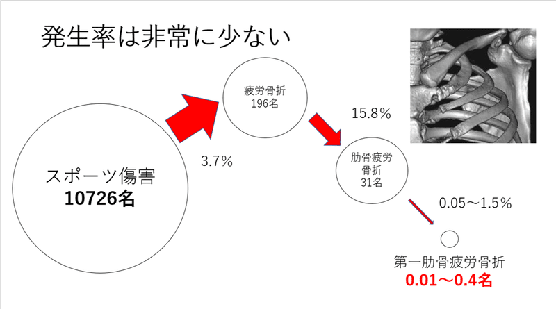 第一肋骨疲労骨折 見逃さないポイント Y K Note