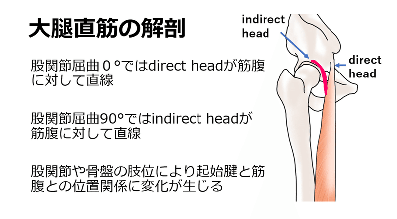 大腿四頭筋の肉離れ Y K Note 大腿四頭筋の肉離れ Y K Note