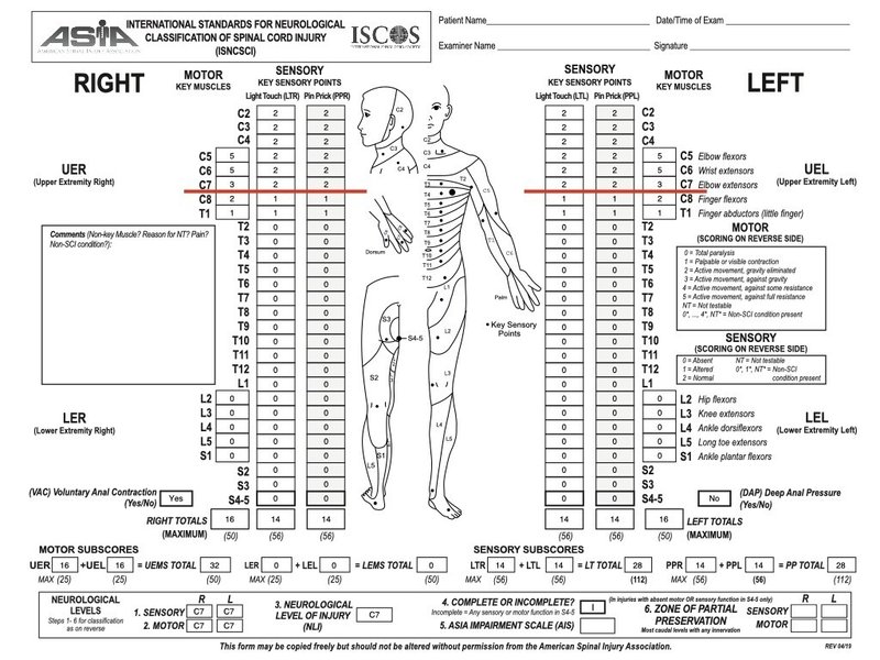 完全版 脊髄損傷の鉄板評価はこれだっ そうちゃん 脊髄損傷の情報発信 Note