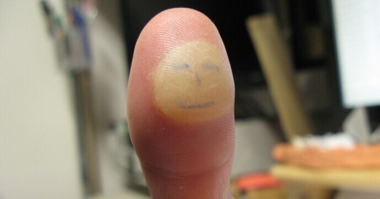 火傷にはキズパワーパッドがいい 幸運な病のレシピ Note 火傷にはキズパワーパッドがいい 幸運な病のレシピ Note