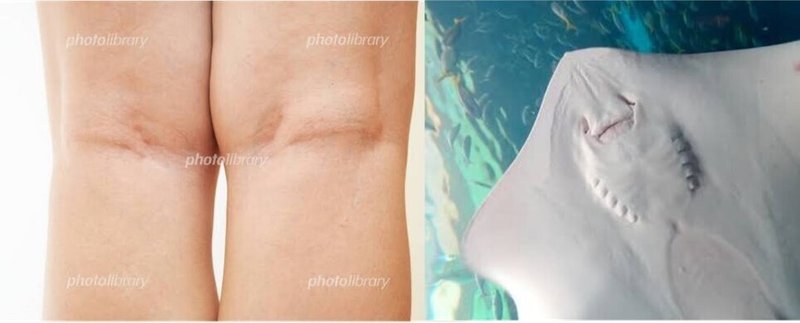 ひざの裏にエイがいる いやマジで 猿人t Note