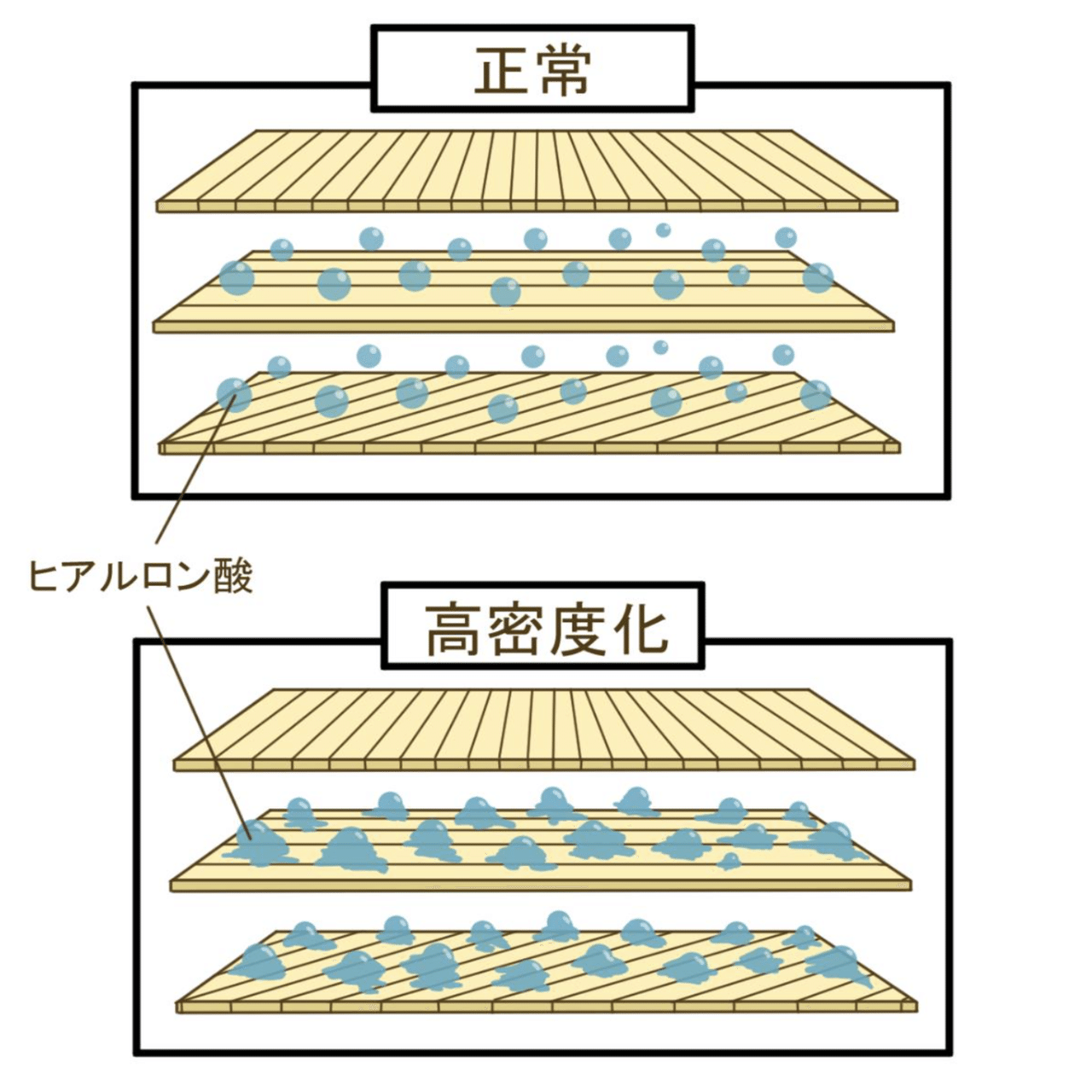 筋膜の教科書】なぜ筋膜へアプローチするのか、このnoteを読めば分かり