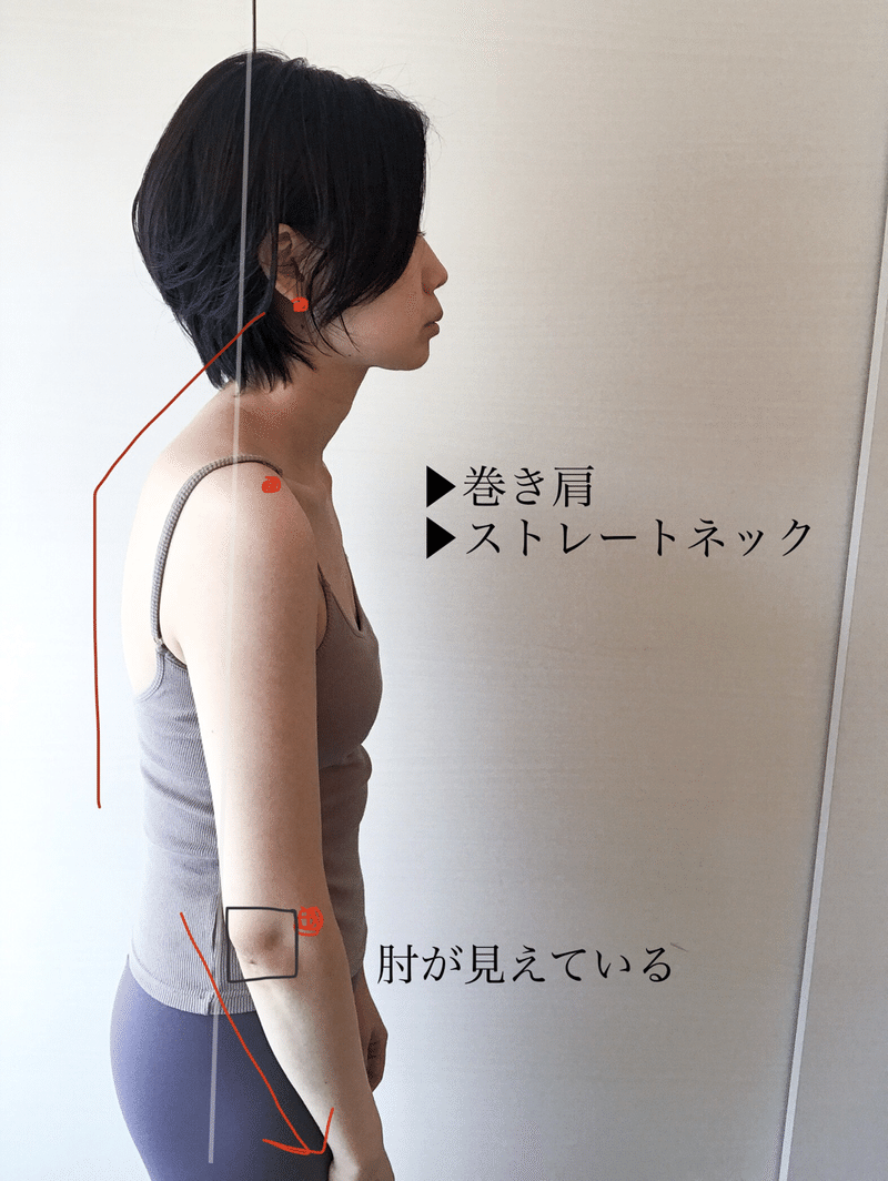 このnoteが役に立つタイプの肩こりはコレ 肩こりセラピスト山口奈緒 Note このnoteが役に立つタイプの肩こりはコレ 肩こりセラピスト山口奈緒 Note