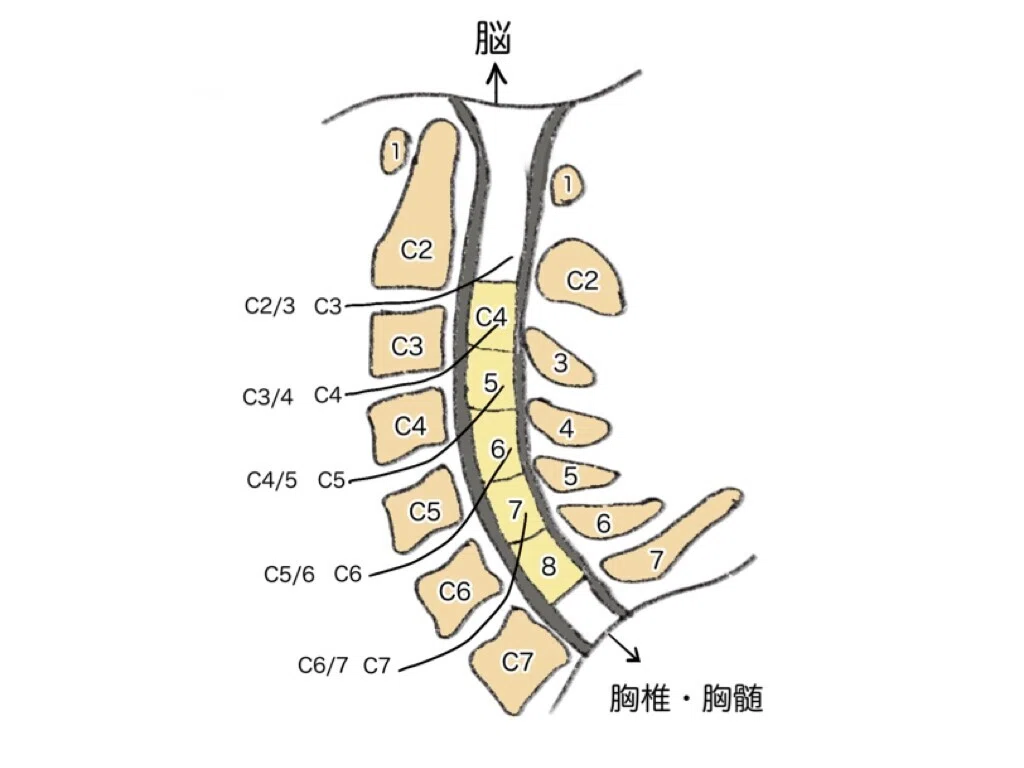 8分で解説：画像問題】PTOT国家試験 脊髄損傷領域 No.49 PM-12 #せき
