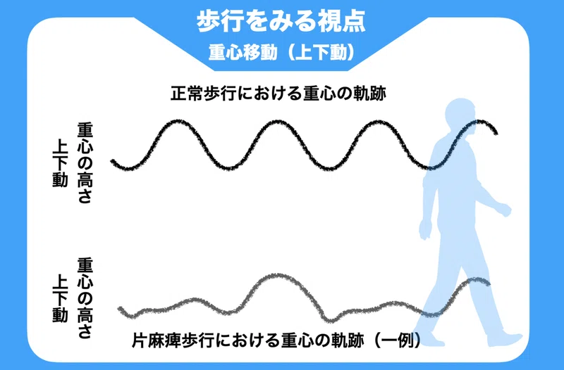 歩行分析に必要な臨床的視点 重心位置を把握する重要性とは 中上博之 理学療法士 Note