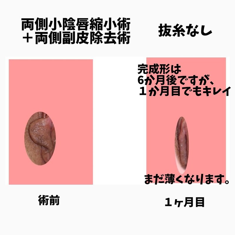 唇 陰 腫れ 痛み 大 大陰唇の色や大きいのが悩み｜陰部の膨らみが気になる方に伝えたい手術について