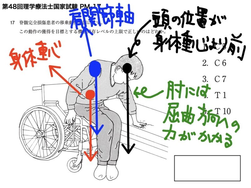 4分で解説 絵問題 Ptot国家試験 脊髄損傷領域 第48回 Pm 問題17 せきそん国試 そうちゃん 脊髄損傷について理学療法士が情報発信 Note 4分で解説 絵問題 Ptot国家試験 脊髄損傷領域 第48回 Pm 問題17 せきそん国試 そうちゃん 脊髄損傷について理学療法士が情報発信 Note
