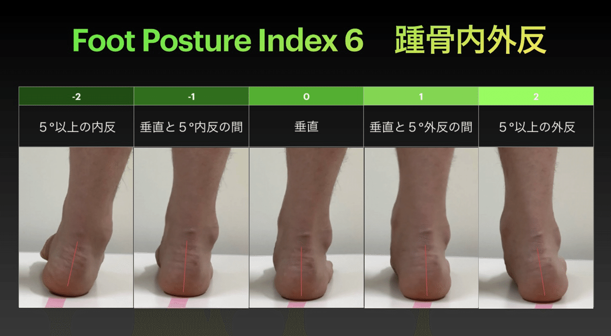 足部のバイオメカニクス評価｜PTタイガー