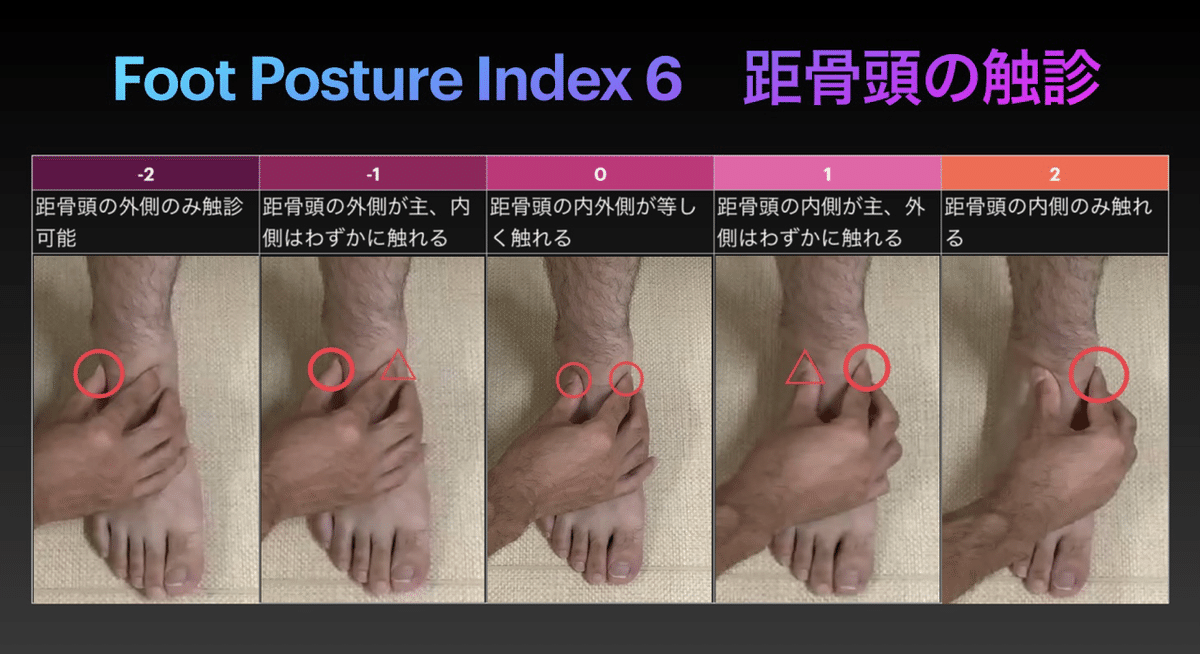 足部のバイオメカニクス評価｜PTタイガー