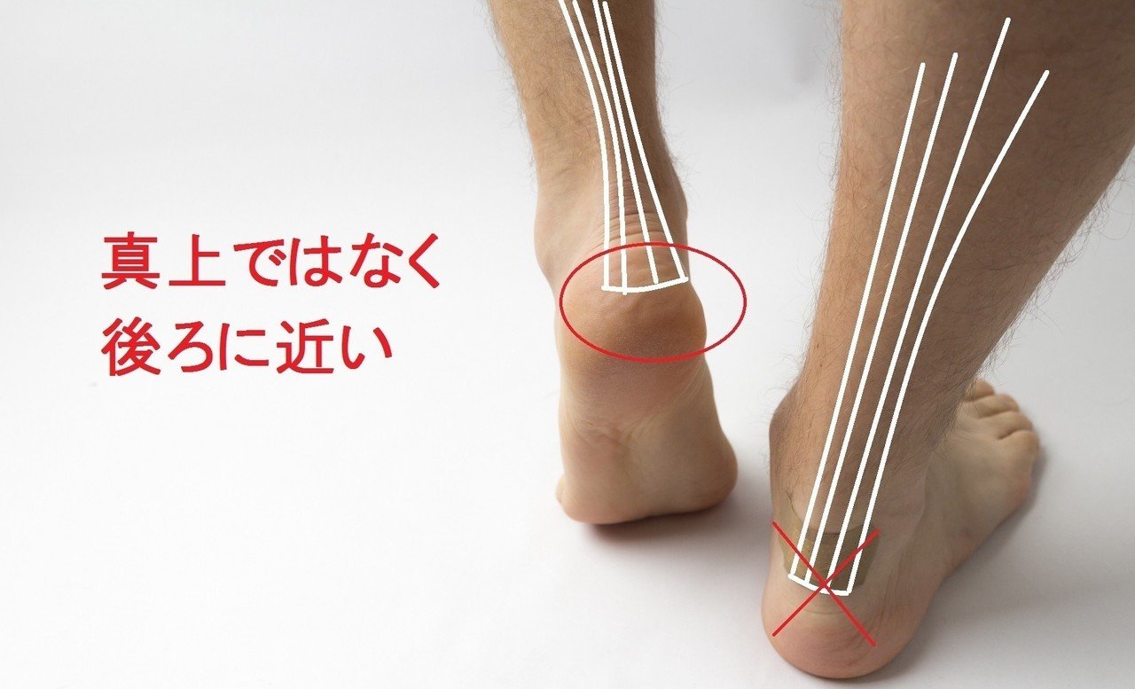 アキレス腱炎の7つの治療アプローチ方法 よう Bp Note