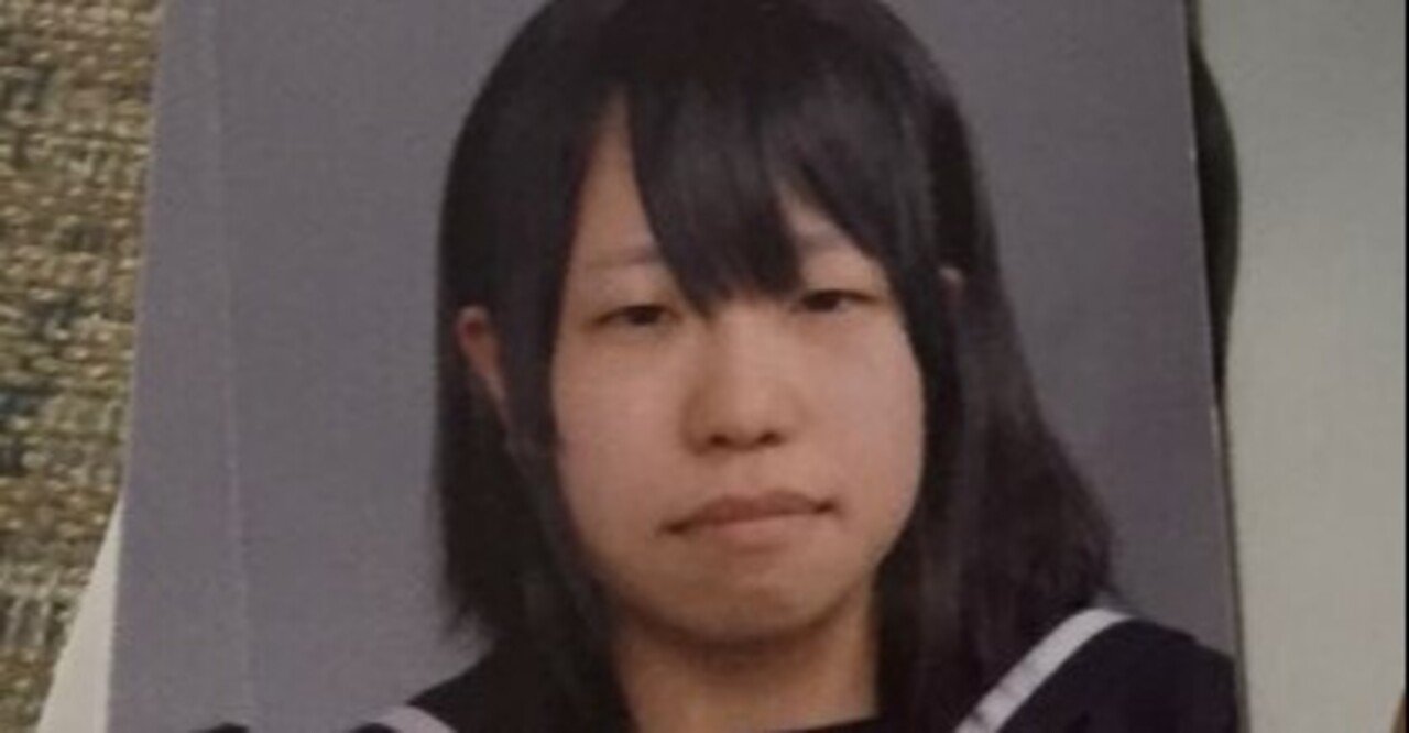 私の顔は醜い 容姿にコンプレックスを抱えた学生時代 そして初めての整形 みきしぃ Note