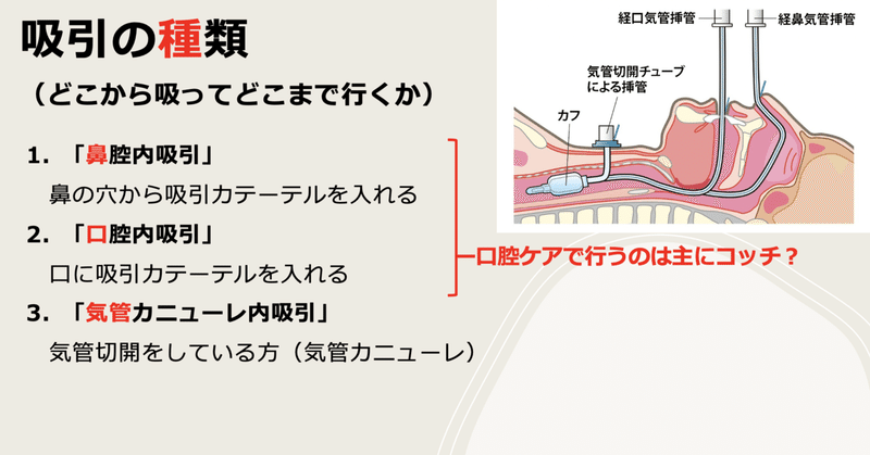 Boc Group Casual Meeting 上手な吸引方法が知りたーい Bocプロバイダー編集部 Note