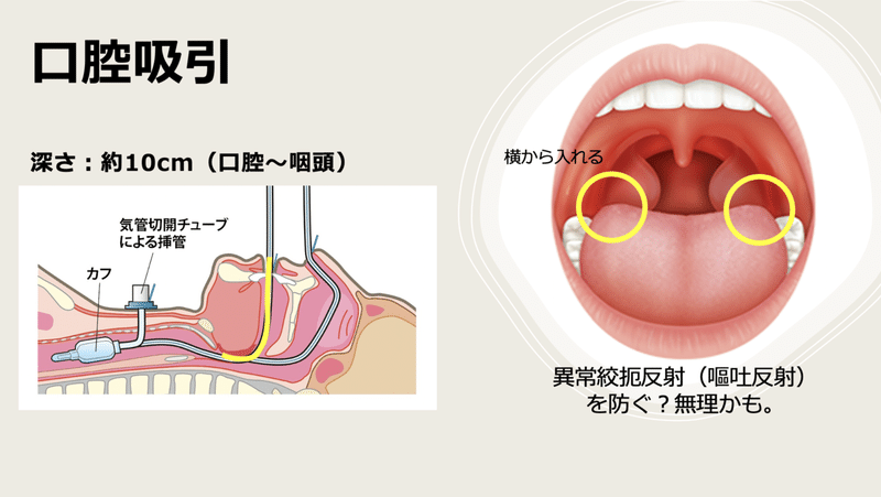 Boc Group Casual Meeting 上手な吸引方法が知りたーい Bocプロバイダー編集部 Note