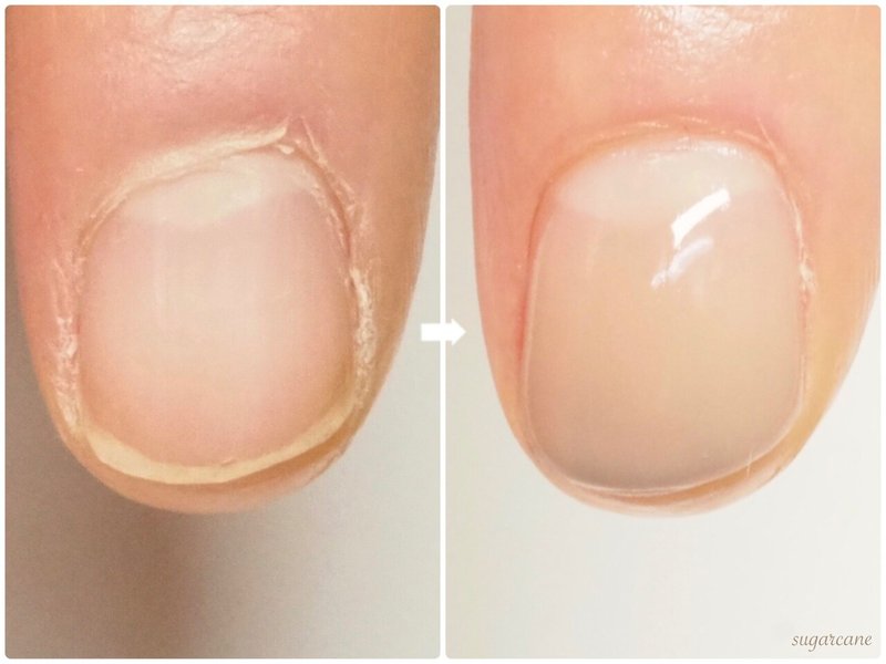 爪周りが硬くなる原因は Nailsalon Sugarcane Note