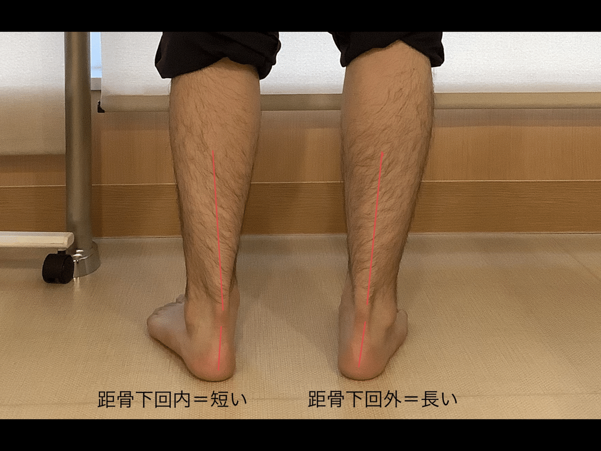 足部のバイオメカニクス評価｜PTタイガー