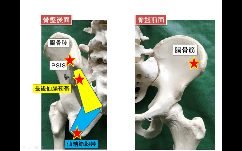 仙腸関節障害による腰痛 Lee Note