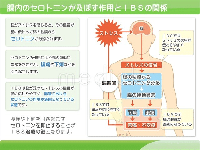 毎日 下痢 妊娠後期の下痢の原因とは 正しい対策方法についてもご紹介 Amp Petmd Com