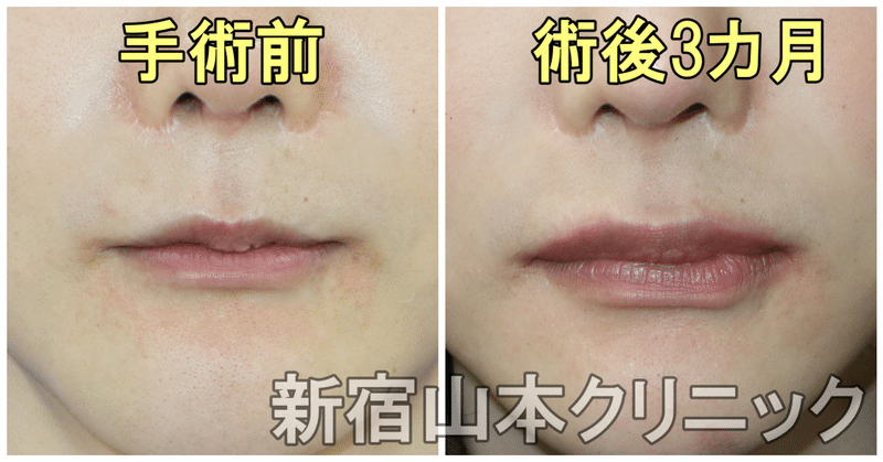 リップリフト の新着タグ記事一覧 Note つくる つながる とどける