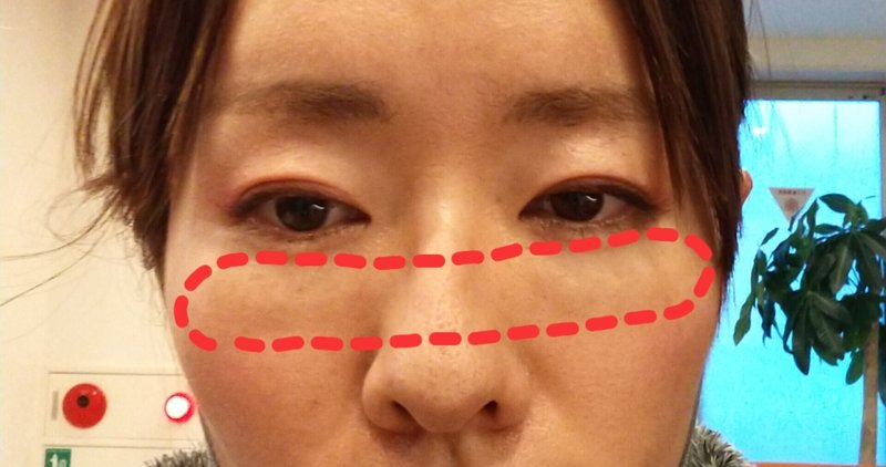 整形中毒 の新着タグ記事一覧 Note つくる つながる とどける