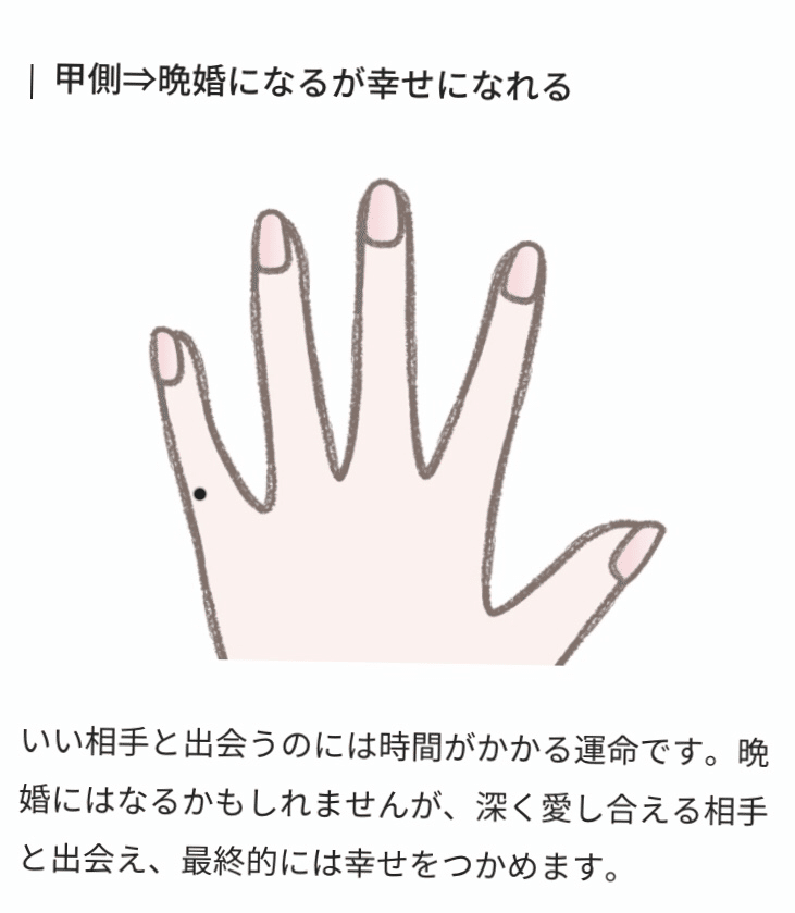 左手小指にほくろが出来てた B子 Note 左手小指にほくろが出来てた B子 Note