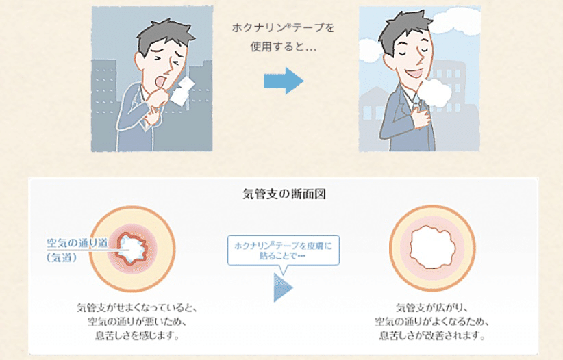 36 ホクナリン テープ あやこ Note