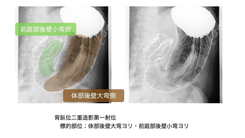 第一斜位.002