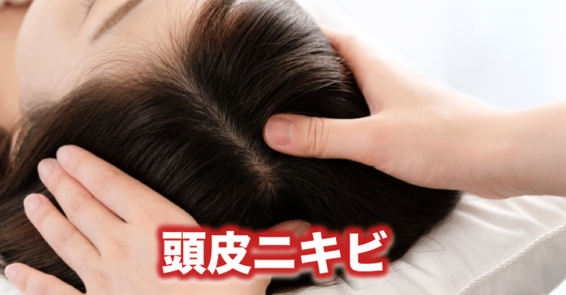 頭皮ニキビ 片柳ちひろ ニキビ博士 Note 頭皮ニキビ 片柳ちひろ ニキビ博士 Note