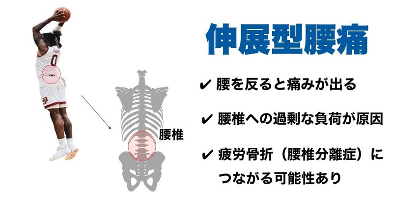 腰を反ると痛む バスケットボールでの腰痛の原因と予防 宮田 洋佑 柔道整復師 アスレティックトレーナー Note